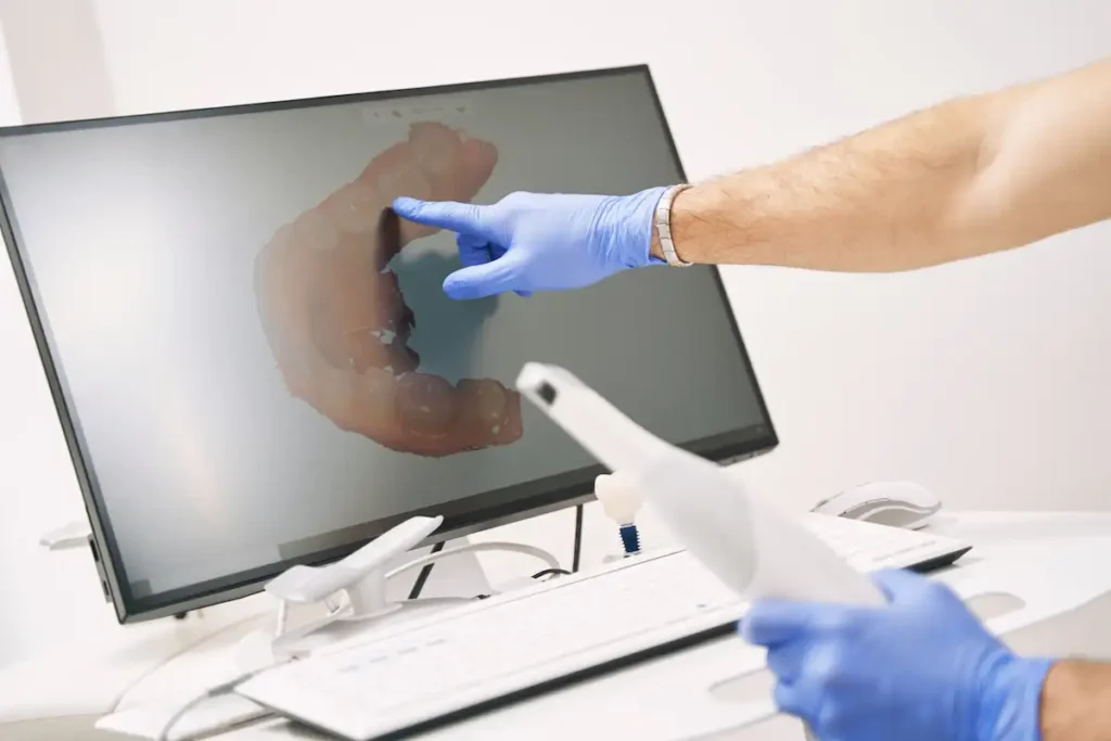 Odontólogo realizando escaneo intraoral para diseñar una prótesis dental removible