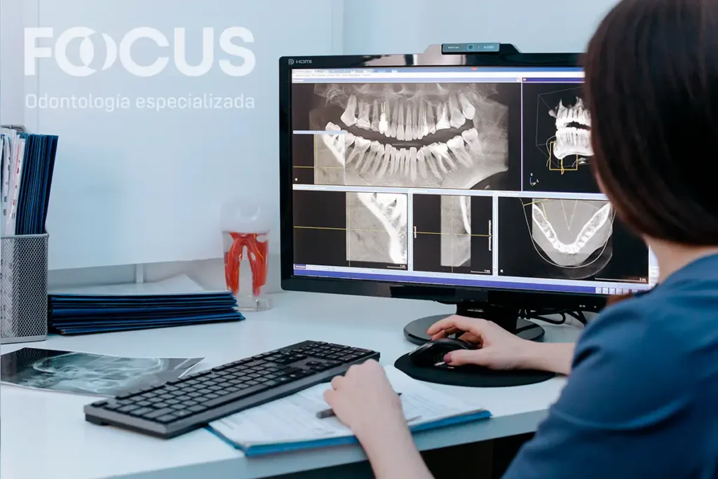 Radiografía dental digital utilizada para diagnosticar si un diente necesita endodoncia