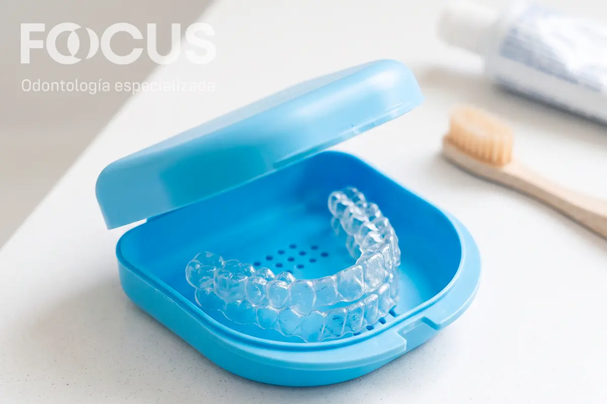 Retenedores dentales transparentes tipo Essix sobre un estuche en consultorio de ortodoncia en Quito.